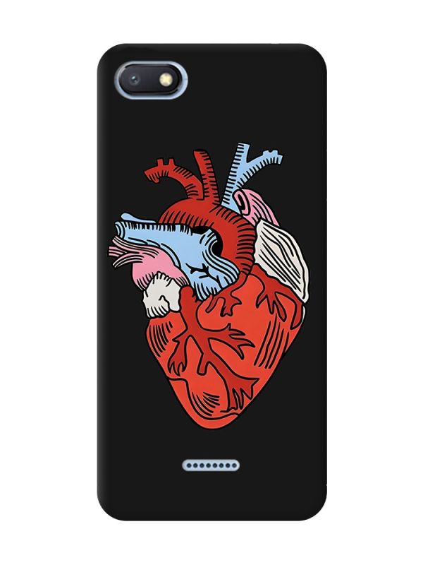 Матовий чорний чохол на Xiaomi Redmi 6A :: Серце анатомічне (принт 250)