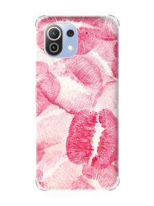 Чохол з потовщеними кутами на Xiaomi Mi 11 Lite :: Цьомики (принт 93)