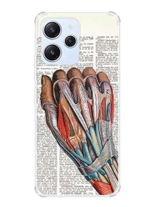 Чохол з потовщеними кутами на Xiaomi Redmi 12 :: Анатомія руки (принт 298)