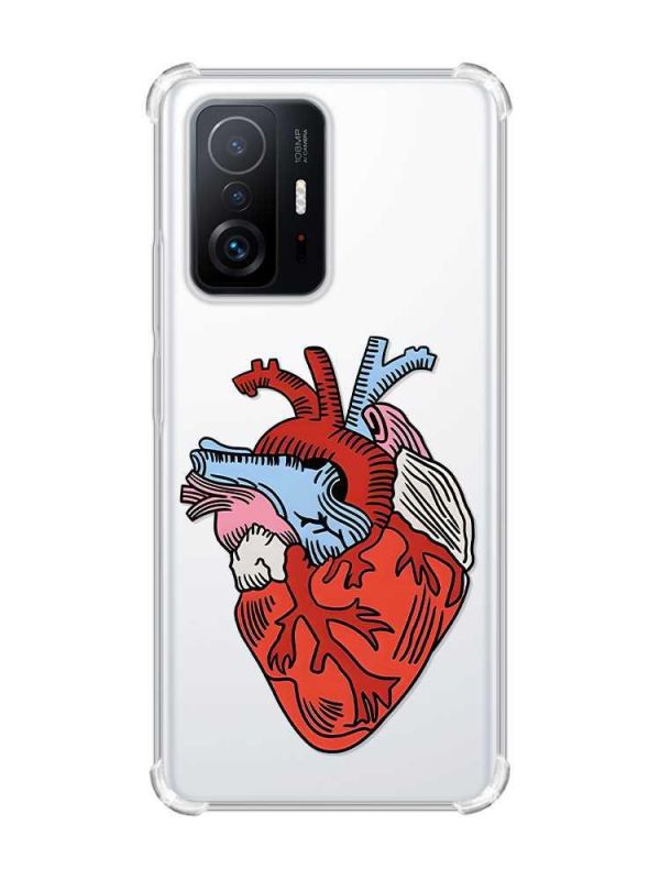 Чохол з потовщеними кутами на Xiaomi 11T :: Серце анатомічне (принт 250)