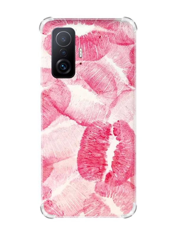 Чохол з потовщеними кутами на Xiaomi 11T :: Цьомики (принт 93)